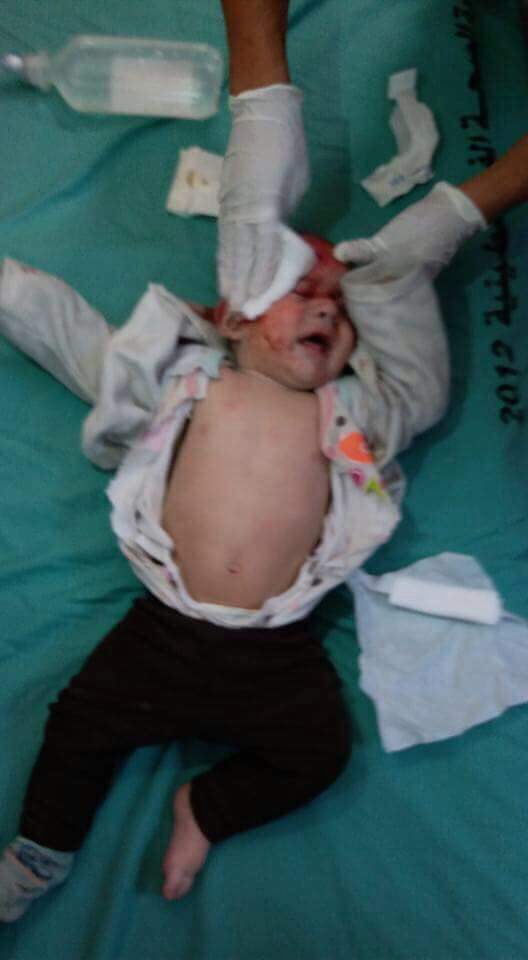 nino-palestino-herido