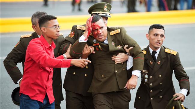militar-venezolano-herido