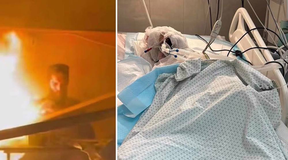 palestinian-journalist-ahmad-mansour-dies-burns